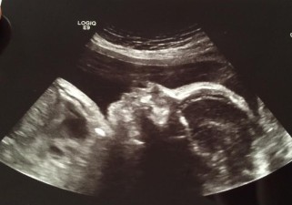 29 weeks {ultrasound}